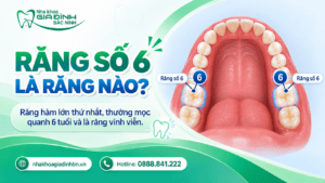 Sâu Răng Số 6: Dấu Hiệu, Có Trám Được Không Và Khi Nào Cần Chữa Tủy? 2 Răng số 6 là răng nào
