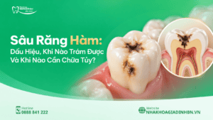 sau rang ham