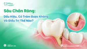 Sau chan rang 1