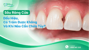 sau rang cua